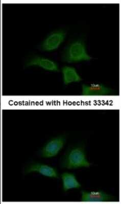 Immunocytochemistry/ Immunofluorescence: Sec8 Antibody [NBP2-20283]