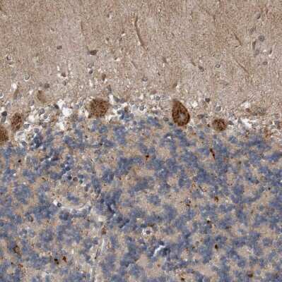 Immunohistochemistry-Paraffin: Sec8 Antibody [NBP1-83944]