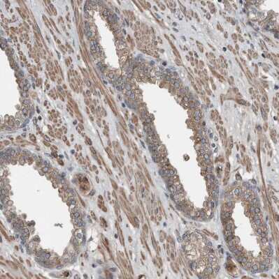 Immunohistochemistry-Paraffin: Sec8 Antibody [NBP1-83944]