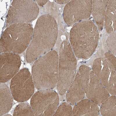 Immunohistochemistry-Paraffin: Sec8 Antibody [NBP1-83944]