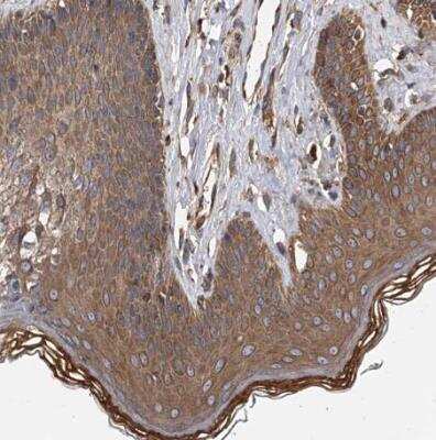 Immunohistochemistry-Paraffin: Sec8 Antibody [NBP1-89597]