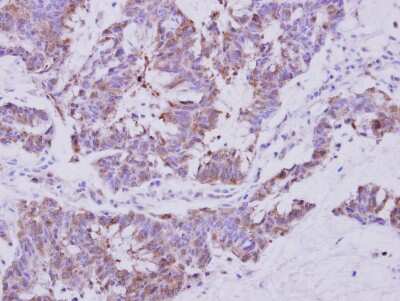 Immunohistochemistry-Paraffin: Sec8 Antibody [NBP2-20283]