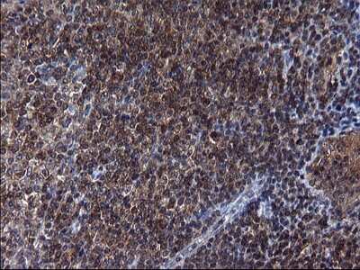 Immunohistochemistry: Secernin-1 Antibody (OTI1F2) [NBP2-45727]