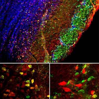 Immunocytochemistry/ Immunofluorescence: Secretagogin Antibody [NBP3-05545]