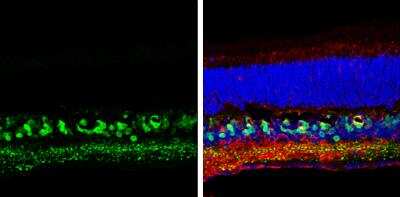 Immunohistochemistry-Frozen: Secretagogin Antibody [NBP2-20286]