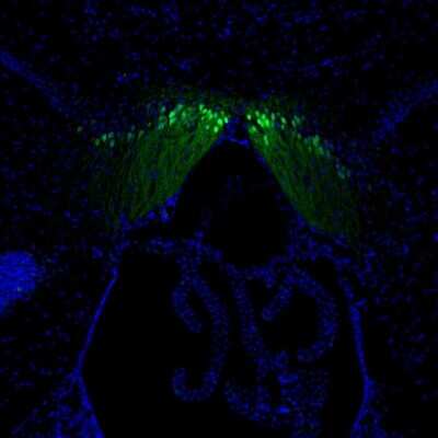Immunohistochemistry: Secretagogin Antibody [NBP1-88219]