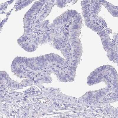 Immunohistochemistry-Paraffin: Secretagogin Antibody [NBP1-88219]