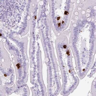 Immunohistochemistry-Paraffin: Secretin Antibody [NBP2-48988]