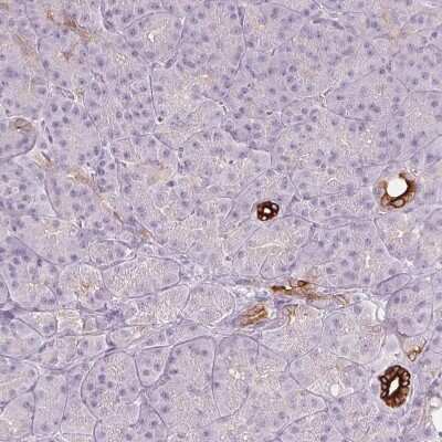 Immunohistochemistry-Paraffin: Secretin R Antibody [NBP1-86125]
