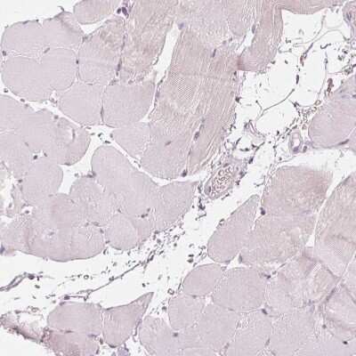 Immunohistochemistry-Paraffin: Secretin R Antibody [NBP1-86125]