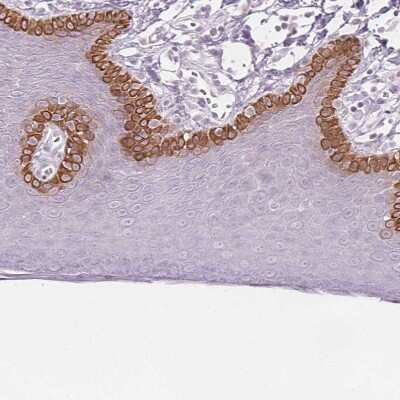 Immunohistochemistry-Paraffin: Secretin R Antibody [NBP1-86125]