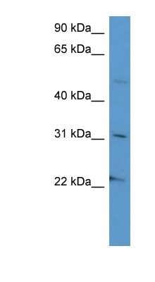 Western Blot: Secretogranin 3 Antibody [NBP1-79762]