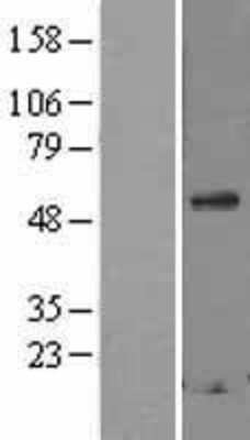Western Blot: Secretogranin 3 Overexpression Lysate [NBL1-15730]