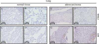 Immunohistochemistry: Secretory phospholipase A2 Type V Antibody [NBP2-31558]