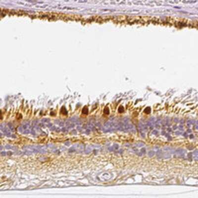 Immunohistochemistry-Paraffin: Secretory phospholipase A2 Type V Antibody [NBP2-31558]