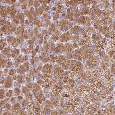 Immunohistochemistry: Seladin 1 Antibody [NBP2-38980]