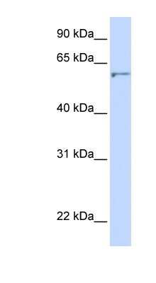 Western Blot: Seladin 1 Antibody [NBP1-59369]