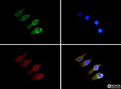Immunocytochemistry/ Immunofluorescence: Semaphorin 3B Antibody [NB100-2218]
