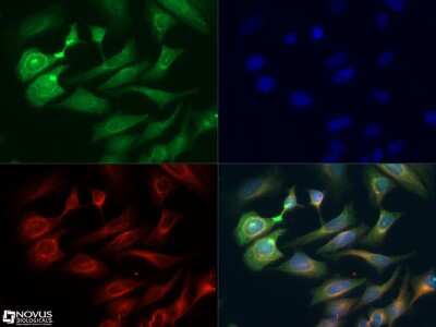 Immunocytochemistry/ Immunofluorescence: Semaphorin 3B Antibody [NB100-2218]