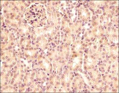 Immunohistochemistry-Paraffin: Semaphorin 3B Antibody [NB100-2218]
