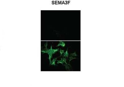 Immunohistochemistry: Semaphorin 3F Antibody [NBP1-91480]