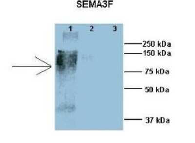 Immunohistochemistry: Semaphorin 3F Antibody [NBP1-91480]