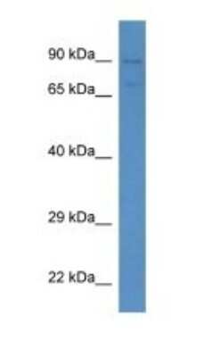 Western Blot: Semaphorin 3F Antibody [NBP1-91480]