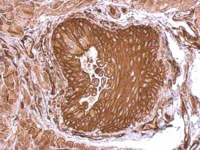 Immunohistochemistry-Paraffin: Semaphorin 4B Antibody [NBP2-19299]