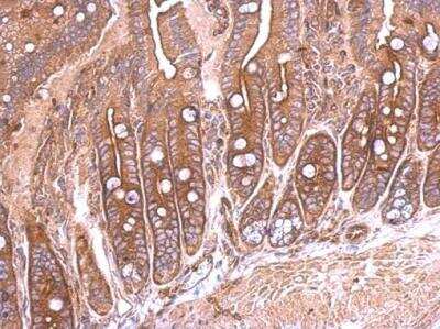 Immunohistochemistry-Paraffin: Semaphorin 4B Antibody [NBP2-19299]