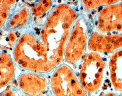 Immunohistochemistry-Paraffin: Semaphorin 5A Antibody [NB100-41107]