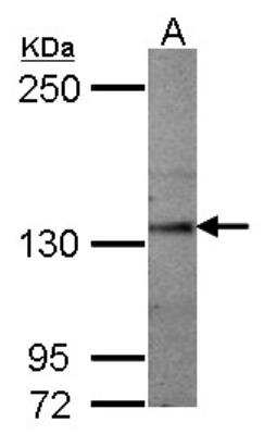 Western Blot: Semaphorin 5A Antibody [NBP2-20290]