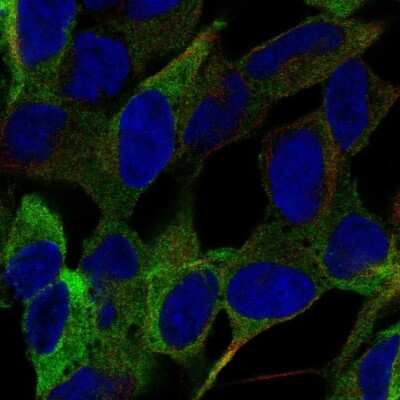Immunocytochemistry/ Immunofluorescence: Semaphorin 5B Antibody [NBP2-56604]