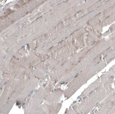 Immunohistochemistry-Paraffin: Semaphorin 7A Antibody [NBP1-86555]
