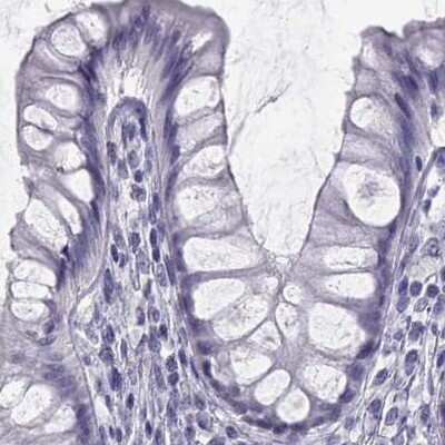 Immunohistochemistry-Paraffin: Semenogelin I Antibody [NBP1-85425]