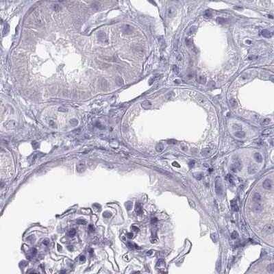 Immunohistochemistry-Paraffin: Semenogelin I Antibody [NBP2-62646]