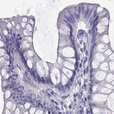 Immunohistochemistry-Paraffin: Semenogelin I Antibody [NBP2-62646]