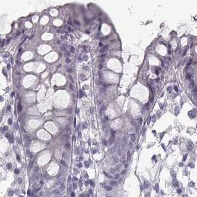 Immunohistochemistry-Paraffin: Semenogelin II Antibody [NBP1-92376]