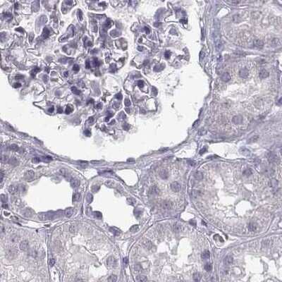 Immunohistochemistry-Paraffin: Semenogelin II Antibody [NBP1-92376]