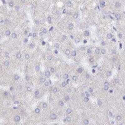 Immunohistochemistry-Paraffin: Semenogelin II Antibody [NBP1-92377]
