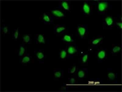 Immunocytochemistry/ Immunofluorescence: Senataxin Antibody (2A9) [H00023064-M05]