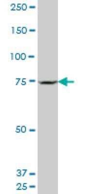 Western Blot: Senataxin Antibody (2A9) [H00023064-M05]
