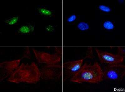 Immunocytochemistry/ Immunofluorescence: Senataxin Antibody - BSA Free [NBP1-94712]