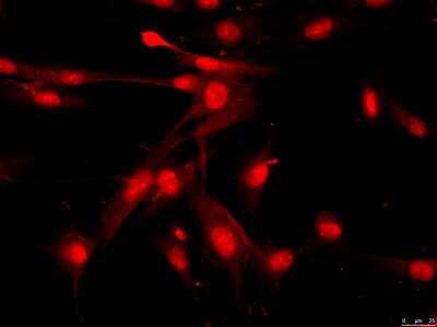 Immunocytochemistry/ Immunofluorescence: Senataxin Antibody - BSA Free [NBP1-94712]