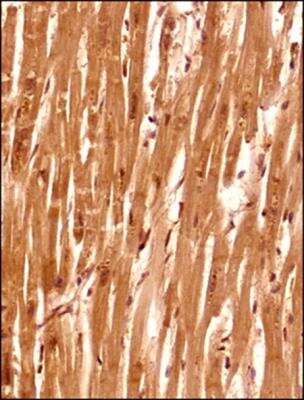 Immunohistochemistry-Paraffin: Senataxin Antibody - BSA Free [NBP1-94712]