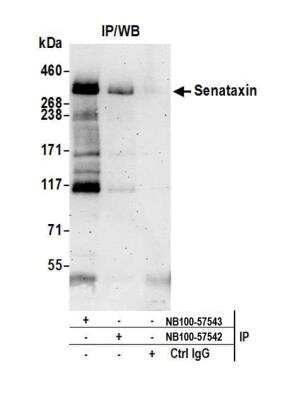 Immunoprecipitation: Senataxin Antibody [NB100-57543]