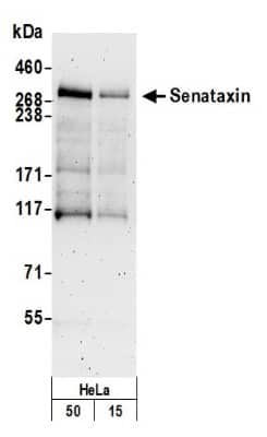 Western Blot: Senataxin Antibody [NB100-57543]