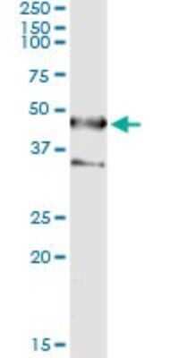 Immunoprecipitation: Septin-1 Antibody (1F12) [H00001731-M03]