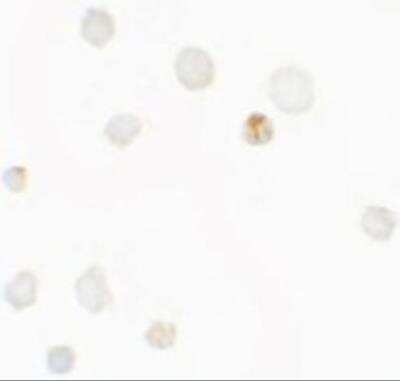 Immunocytochemistry/ Immunofluorescence: Septin-1 Antibody - BSA Free [NBP2-81892]