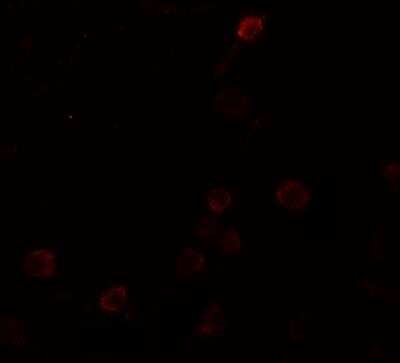 Immunocytochemistry/ Immunofluorescence: Septin-1 Antibody - BSA Free [NBP2-81892]