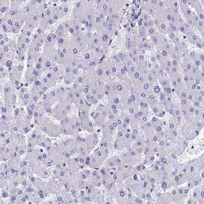 Immunohistochemistry-Paraffin: Septin-1 Antibody [NBP1-84251]